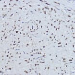 Immunohistochemistry - Anti-Estrogen Related Receptor alpha Antibody (A90033) - Antibodies.com