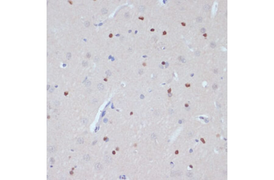 Immunohistochemistry - Anti-Estrogen Related Receptor alpha Antibody (A90033) - Antibodies.com