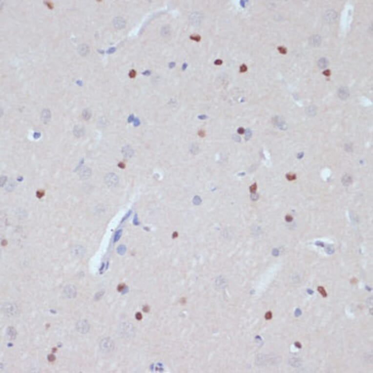 Immunohistochemistry - Anti-Estrogen Related Receptor alpha Antibody (A90033) - Antibodies.com