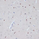 Immunohistochemistry - Anti-Estrogen Related Receptor alpha Antibody (A90033) - Antibodies.com
