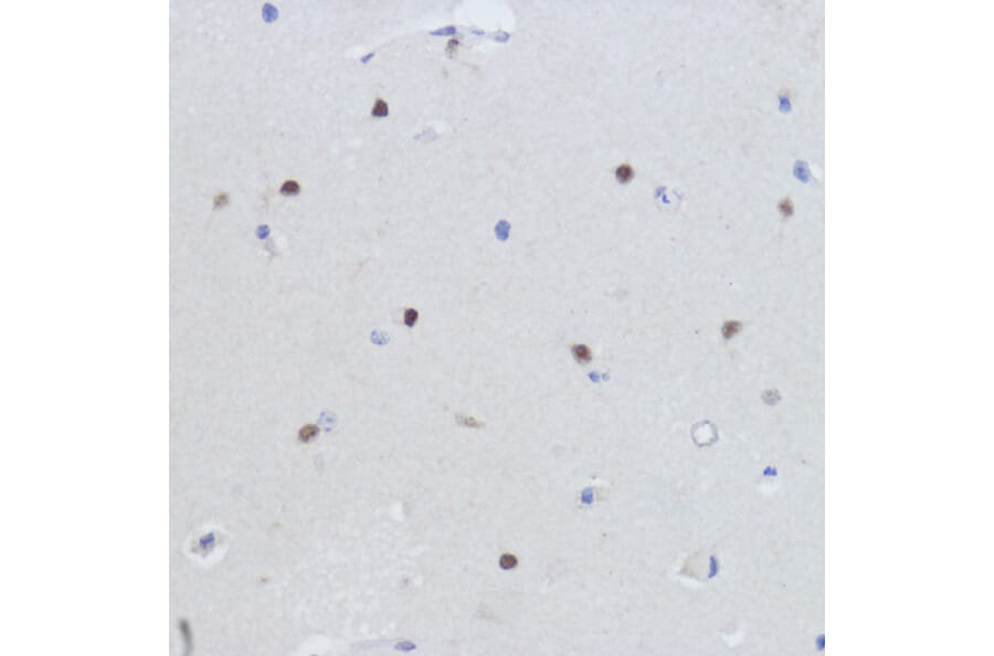 Immunohistochemistry - Anti-Estrogen Related Receptor alpha Antibody (A90033) - Antibodies.com