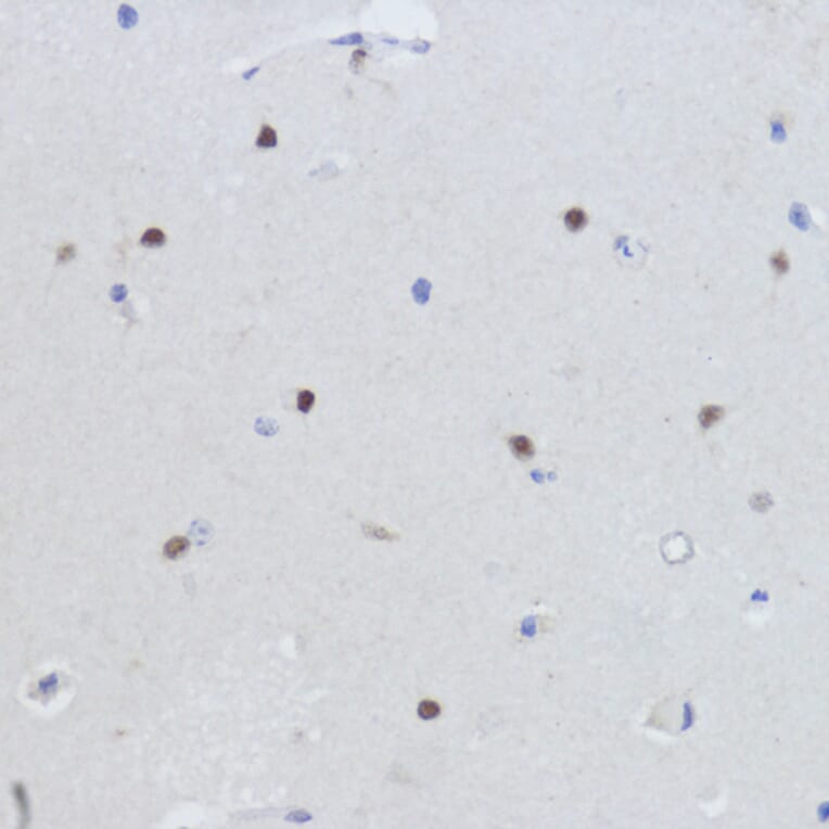 Immunohistochemistry - Anti-Estrogen Related Receptor alpha Antibody (A90033) - Antibodies.com