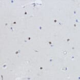 Immunohistochemistry - Anti-Estrogen Related Receptor alpha Antibody (A90033) - Antibodies.com