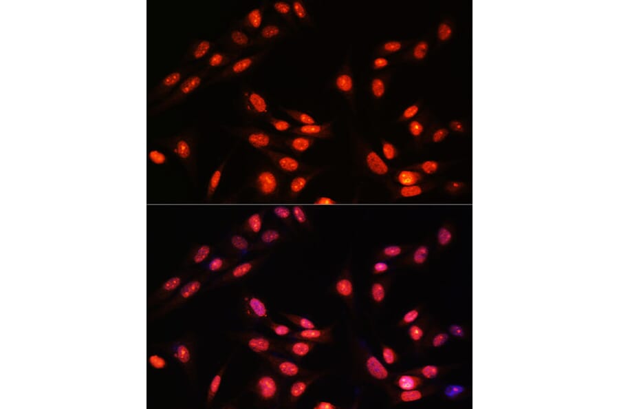 Immunofluorescence - Anti-Estrogen Related Receptor alpha Antibody (A90033) - Antibodies.com