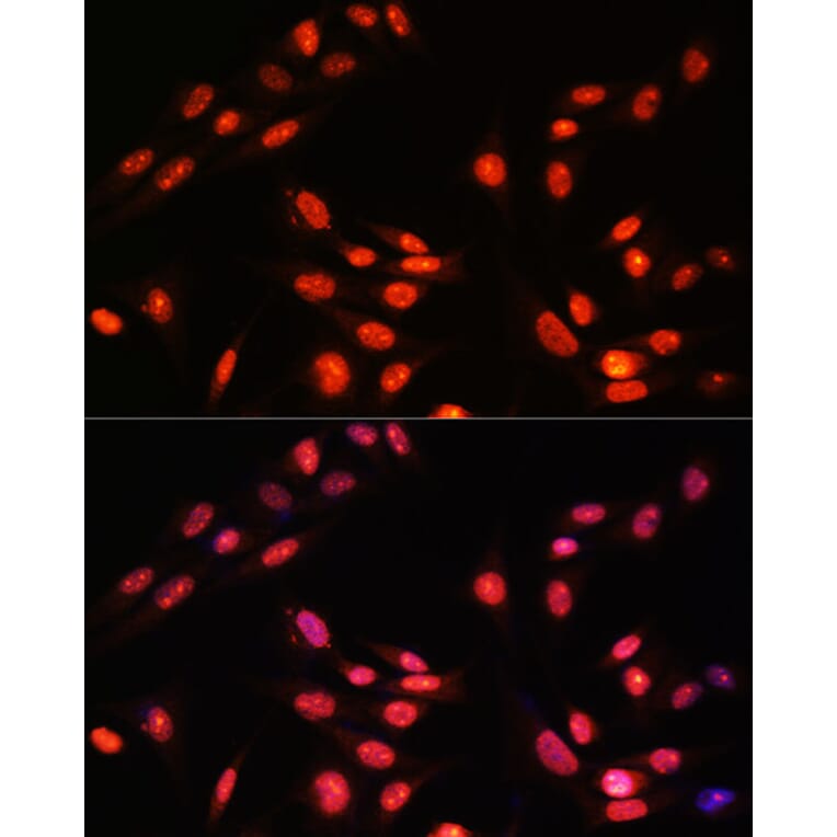 Immunofluorescence - Anti-Estrogen Related Receptor alpha Antibody (A90033) - Antibodies.com