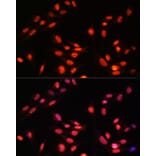 Immunofluorescence - Anti-Estrogen Related Receptor alpha Antibody (A90033) - Antibodies.com