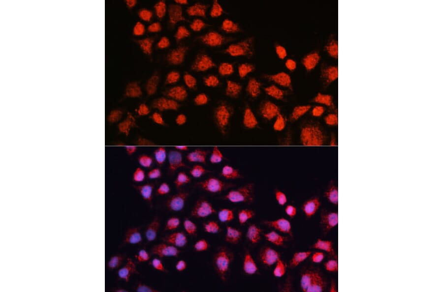 Immunofluorescence - Anti-Estrogen Related Receptor alpha Antibody (A90033) - Antibodies.com