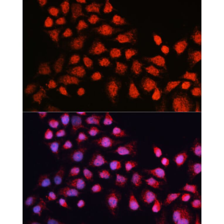 Immunofluorescence - Anti-Estrogen Related Receptor alpha Antibody (A90033) - Antibodies.com