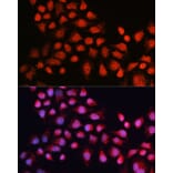 Immunofluorescence - Anti-Estrogen Related Receptor alpha Antibody (A90033) - Antibodies.com
