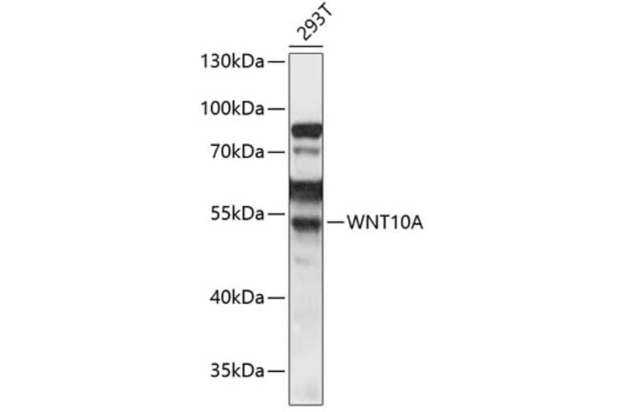 Western Blot - Anti-Wnt10a Antibody (A90035) - Antibodies.com