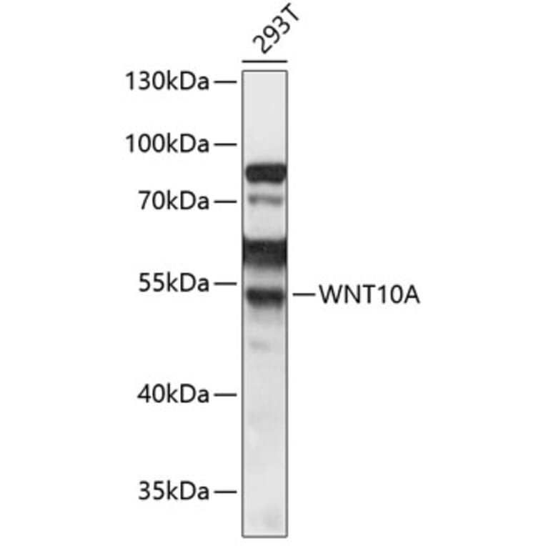 Western Blot - Anti-Wnt10a Antibody (A90035) - Antibodies.com
