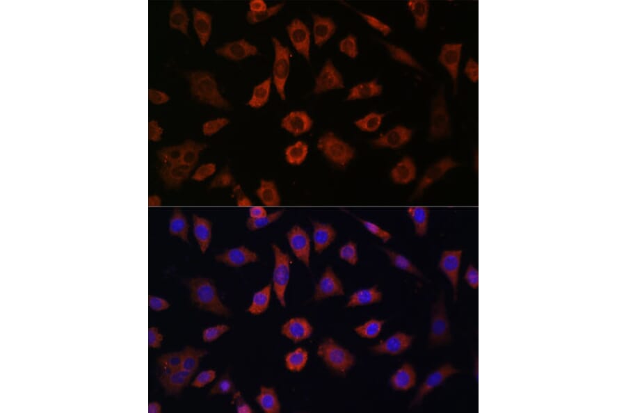 Immunofluorescence - Anti-Cytohesin 1 Antibody (A90036) - Antibodies.com