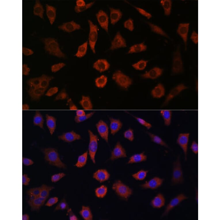 Immunofluorescence - Anti-Cytohesin 1 Antibody (A90036) - Antibodies.com
