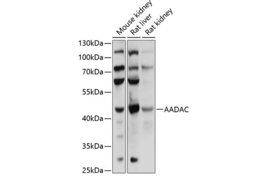 Western Blot - Anti-AADAC/DAC Antibody (A90038) - Antibodies.com