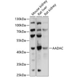 Western Blot - Anti-AADAC/DAC Antibody (A90038) - Antibodies.com