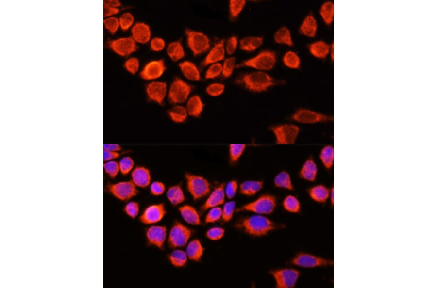 Immunofluorescence - Anti-AADAC/DAC Antibody (A90038) - Antibodies.com