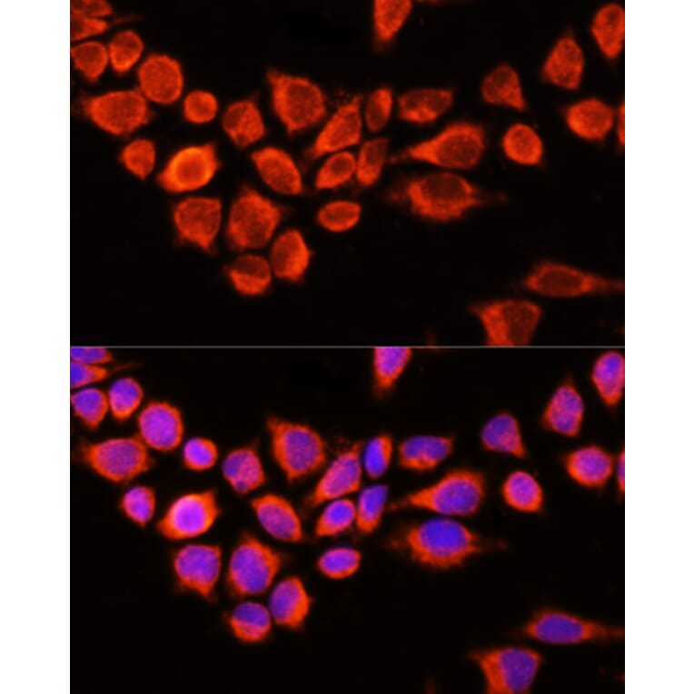 Immunofluorescence - Anti-AADAC/DAC Antibody (A90038) - Antibodies.com