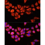 Immunofluorescence - Anti-AADAC/DAC Antibody (A90038) - Antibodies.com