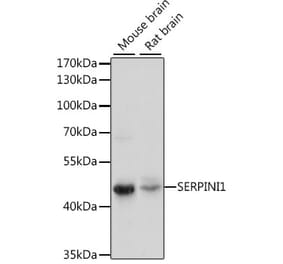 Western Blot - Anti-Neuroserpin Antibody (A90039) - Antibodies.com