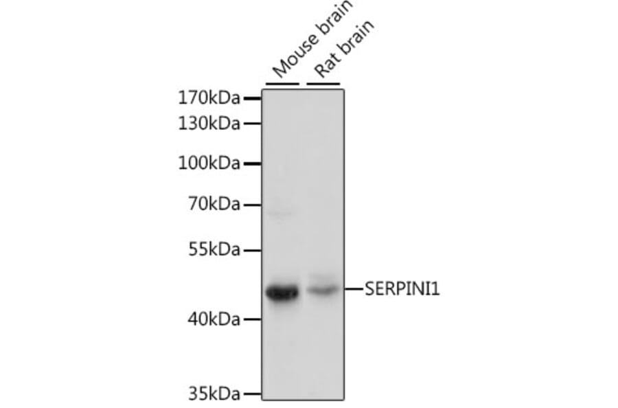 Western Blot - Anti-Neuroserpin Antibody (A90039) - Antibodies.com
