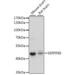 Western Blot - Anti-Neuroserpin Antibody (A90039) - Antibodies.com