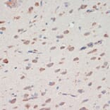 Immunohistochemistry - Anti-Neuroserpin Antibody (A90039) - Antibodies.com