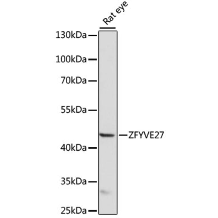Western Blot - Anti-ZFYVE27 Antibody (A90041) - Antibodies.com