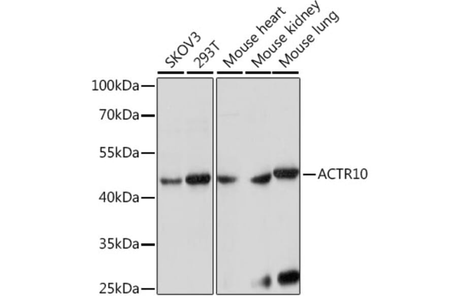 Western Blot - Anti-ACTR10 Antibody (A90042) - Antibodies.com