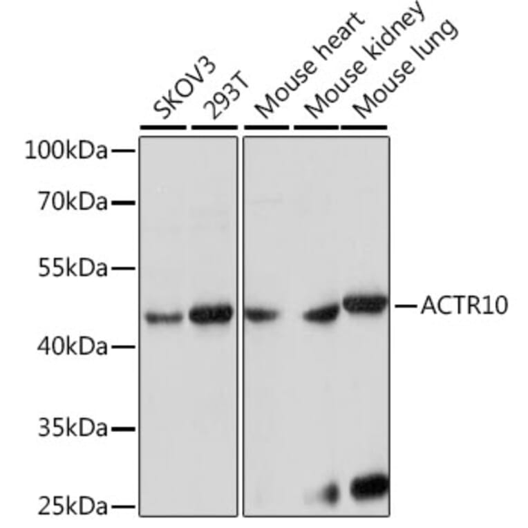 Western Blot - Anti-ACTR10 Antibody (A90042) - Antibodies.com