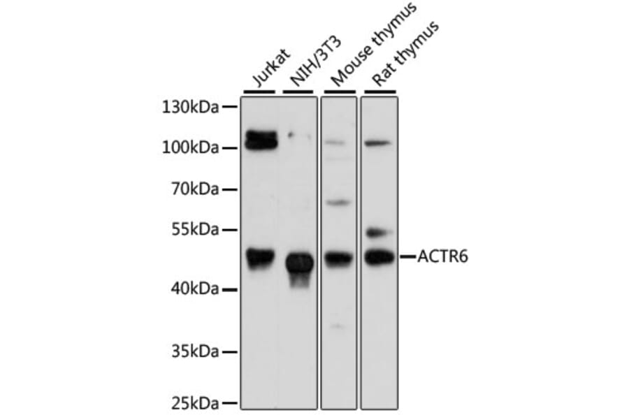 Western Blot - Anti-ACTR6 Antibody (A90043) - Antibodies.com