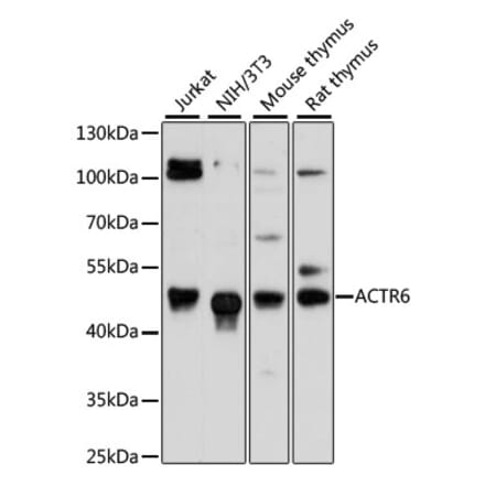 Western Blot - Anti-ACTR6 Antibody (A90043) - Antibodies.com