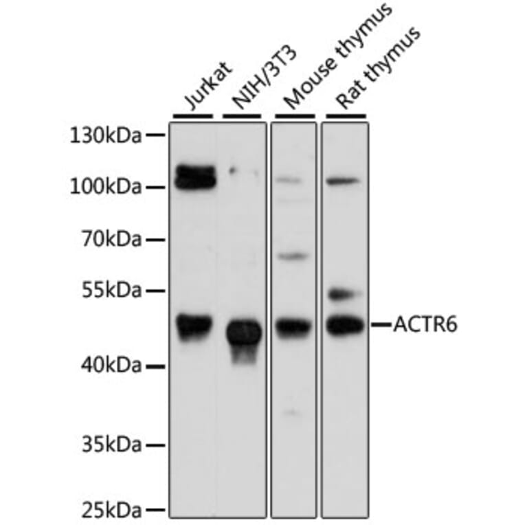 Western Blot - Anti-ACTR6 Antibody (A90043) - Antibodies.com