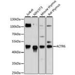 Western Blot - Anti-ACTR6 Antibody (A90043) - Antibodies.com