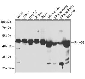 Western Blot - Anti-PHKG2 Antibody (A90044) - Antibodies.com