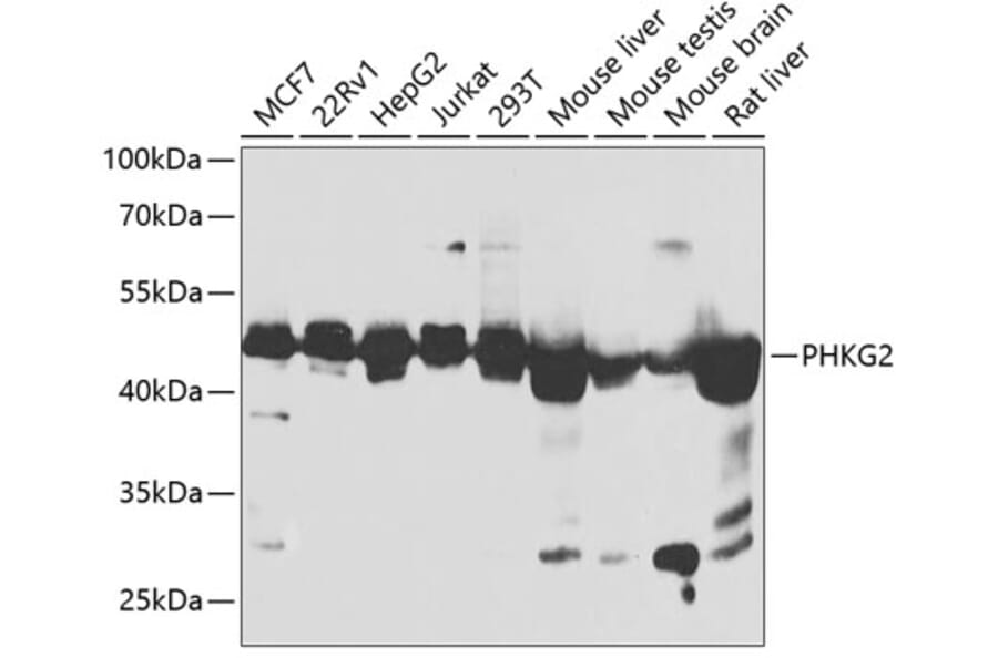 Western Blot - Anti-PHKG2 Antibody (A90044) - Antibodies.com