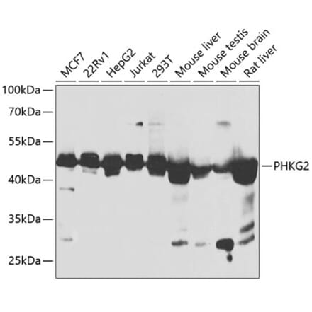 Western Blot - Anti-PHKG2 Antibody (A90044) - Antibodies.com