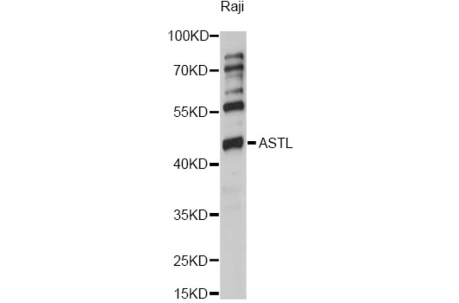 Western Blot - Anti-ASTL Antibody (A14984) - Antibodies.com