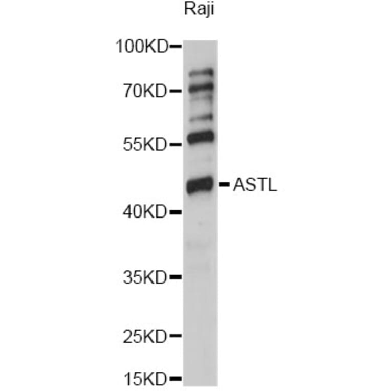Western Blot - Anti-ASTL Antibody (A14984) - Antibodies.com