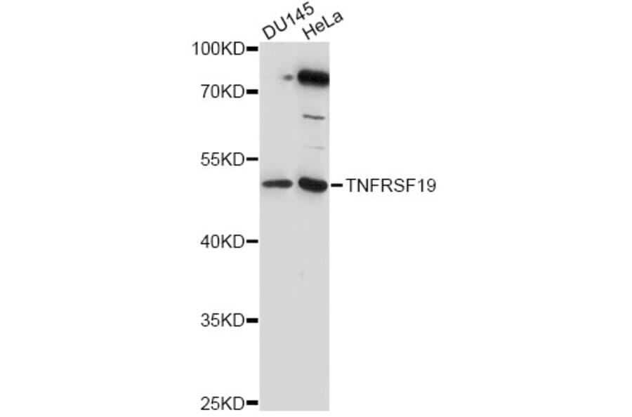 Western Blot - Anti-TNFRSF19 Antibody (A14284) - Antibodies.com
