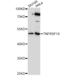 Western Blot - Anti-TNFRSF19 Antibody (A14284) - Antibodies.com
