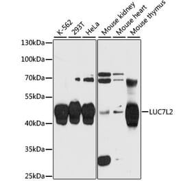 Western Blot - Anti-LUC7L2 Antibody (A90047) - Antibodies.com