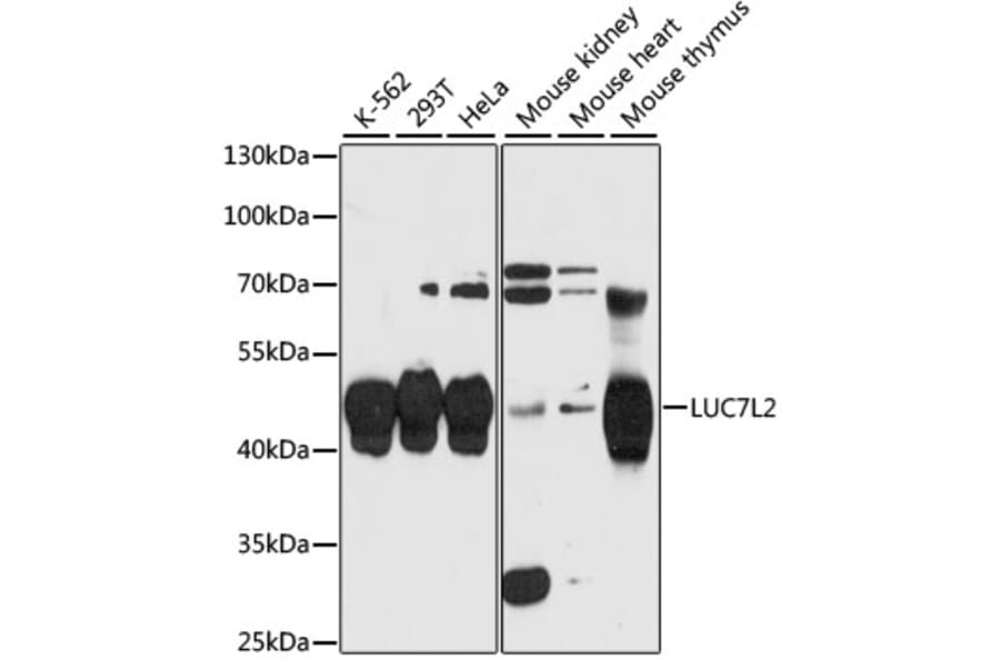 Western Blot - Anti-LUC7L2 Antibody (A90047) - Antibodies.com