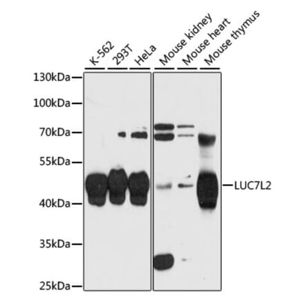 Western Blot - Anti-LUC7L2 Antibody (A90047) - Antibodies.com
