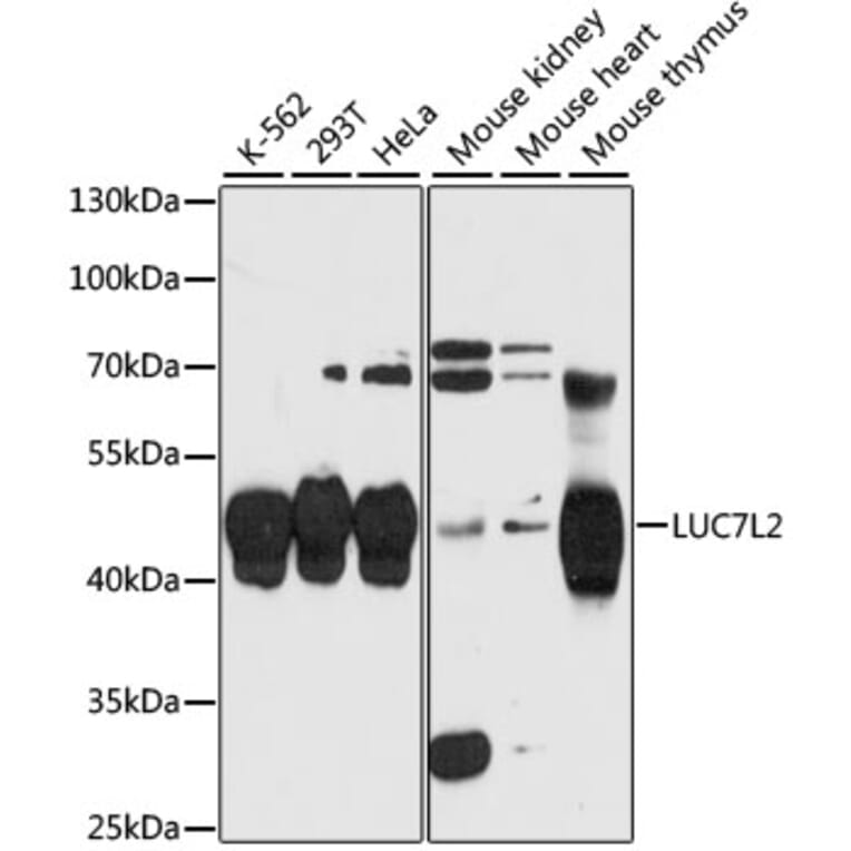 Western Blot - Anti-LUC7L2 Antibody (A90047) - Antibodies.com