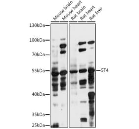 Western Blot - Anti-5T4 Antibody (A90048) - Antibodies.com