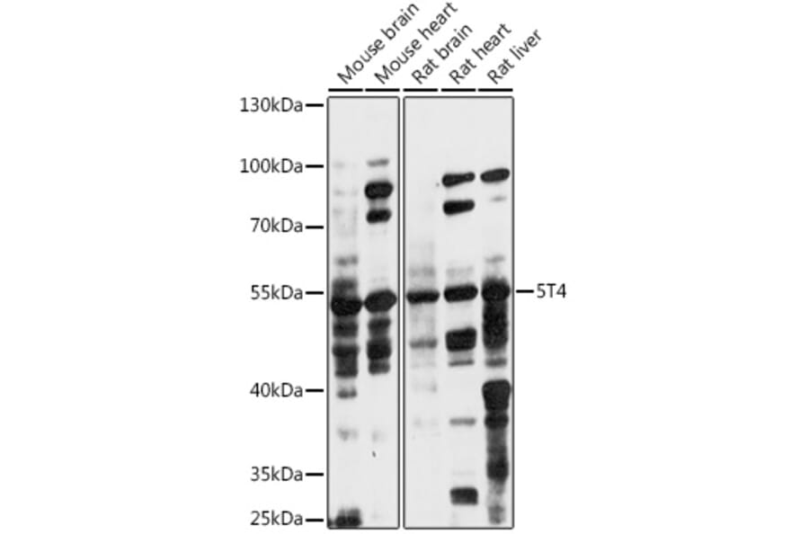 Western Blot - Anti-5T4 Antibody (A90048) - Antibodies.com