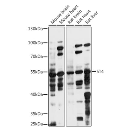 Western Blot - Anti-5T4 Antibody (A90048) - Antibodies.com