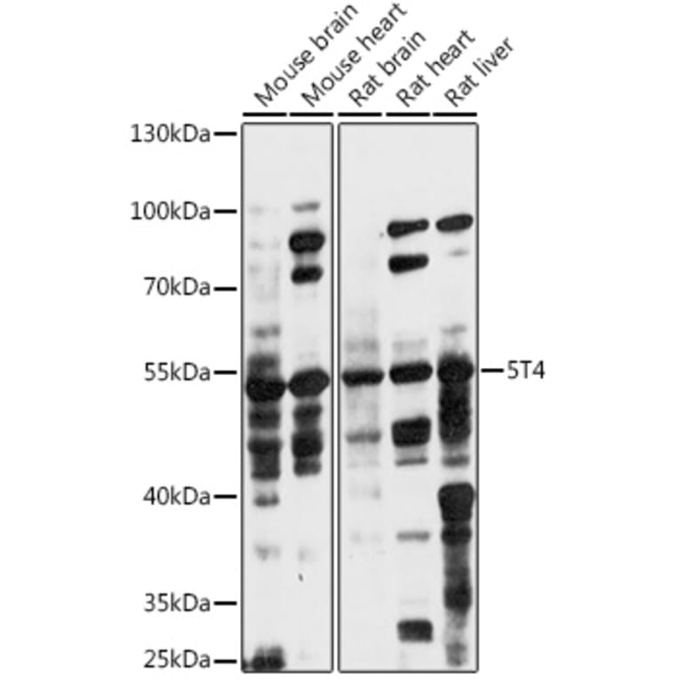 Western Blot - Anti-5T4 Antibody (A90048) - Antibodies.com