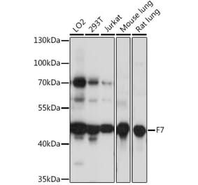 Western Blot - Anti-Factor VII Antibody (A90049) - Antibodies.com