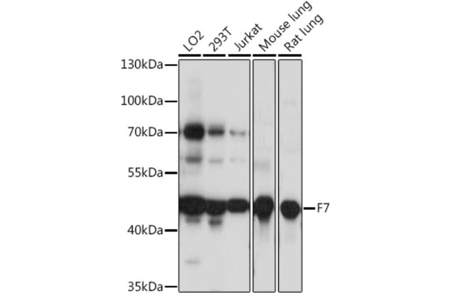 Western Blot - Anti-Factor VII Antibody (A90049) - Antibodies.com